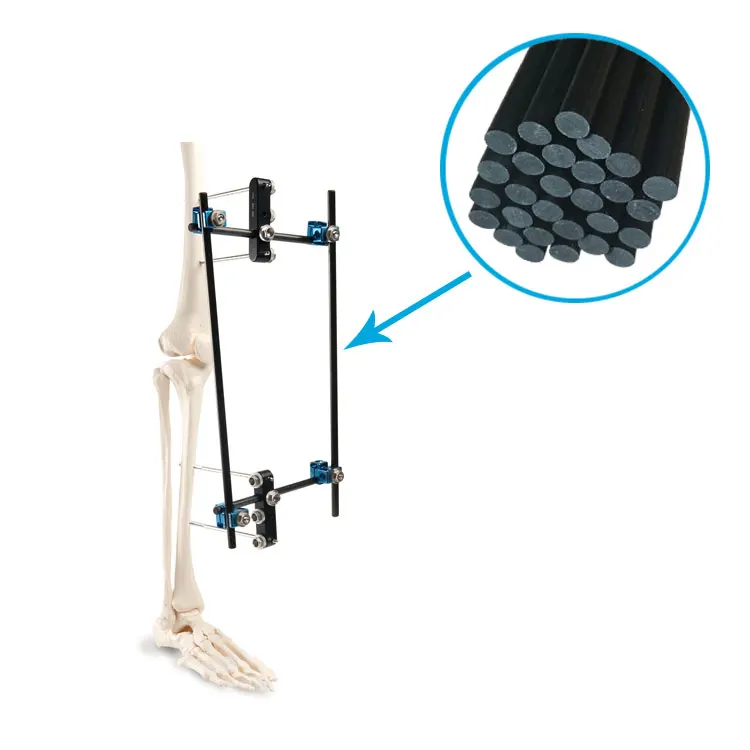 Large Bone Temporary External Fixation System 5mm 8mm 11mm 12mm carbon fiber rods