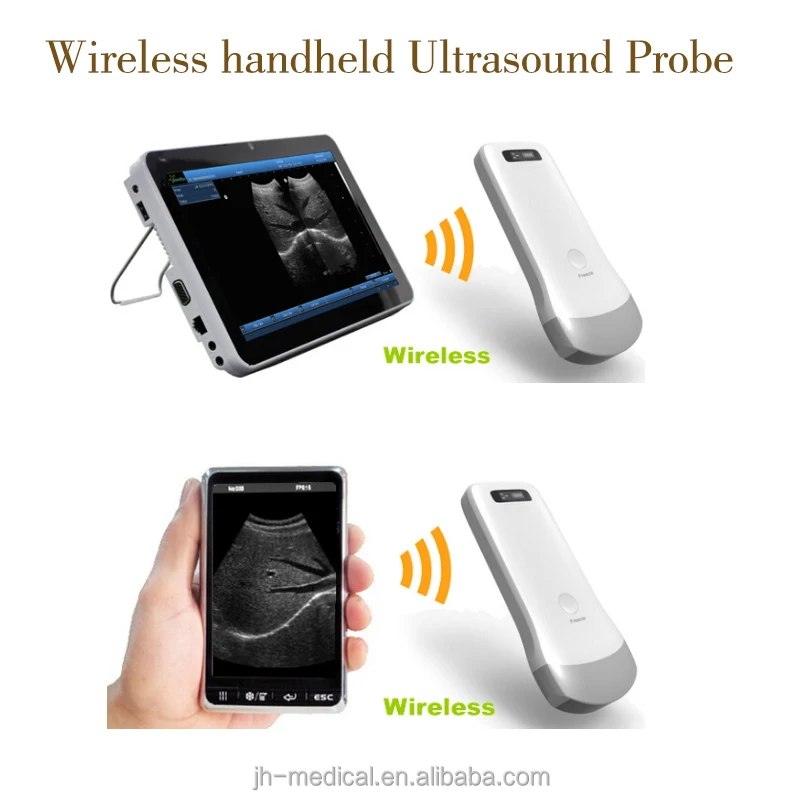 
CE approved usb probe b Wireless ultrasound scanner machine - link to PC or Mobile phone 