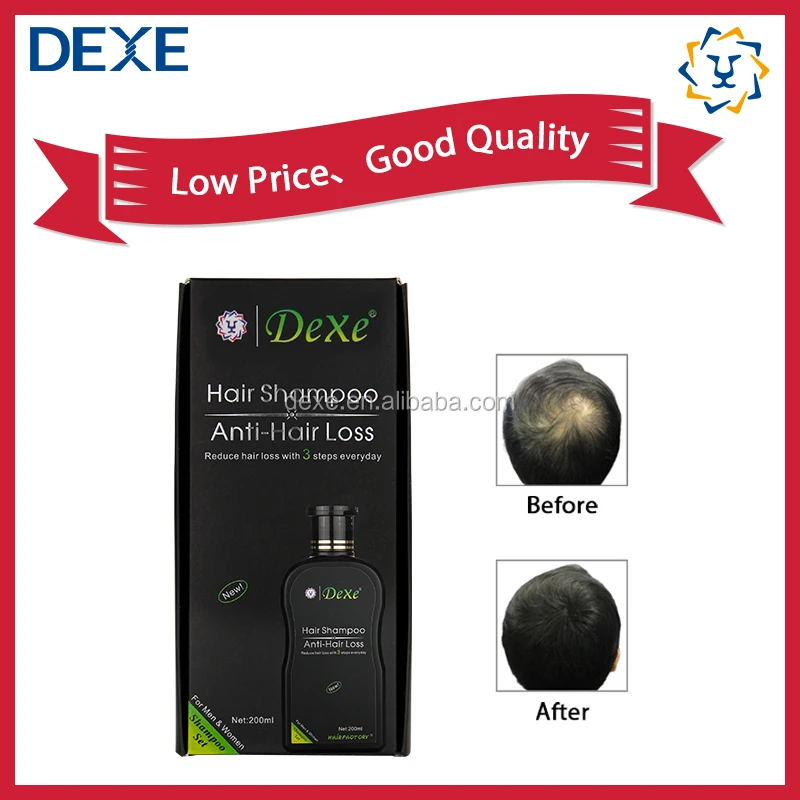 Private label organic natural beauty products hair loss solution oil shampoo and conditioner for protein hair straightener