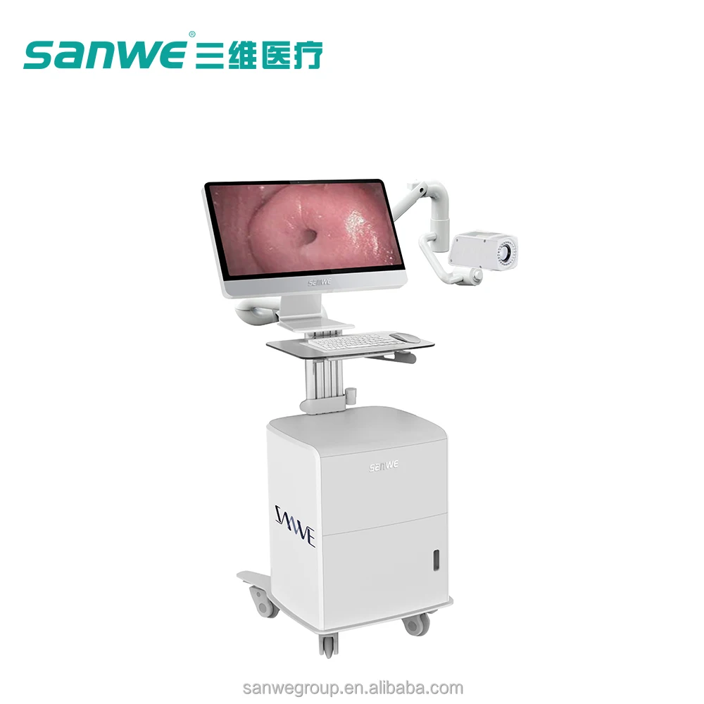 Sanwe кольпоскоп, SW-3305 кольпоскоп с программным обеспечением и камеры, цифровой видеокольпоскоп