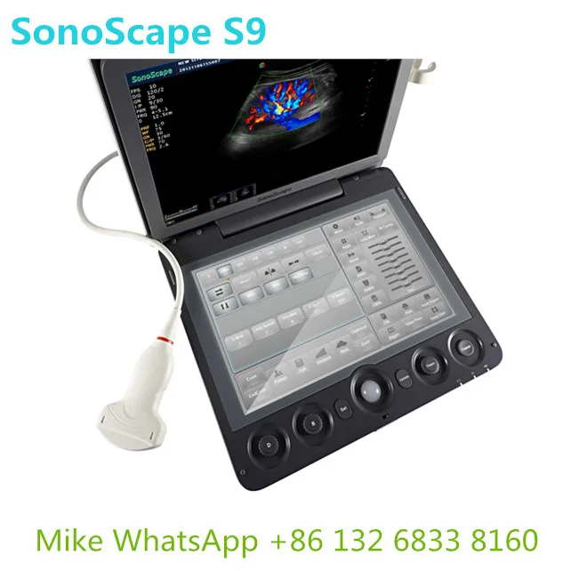  Ультразвуковой допплеровский сканер Sonoscape S9 уверенность в диагностике