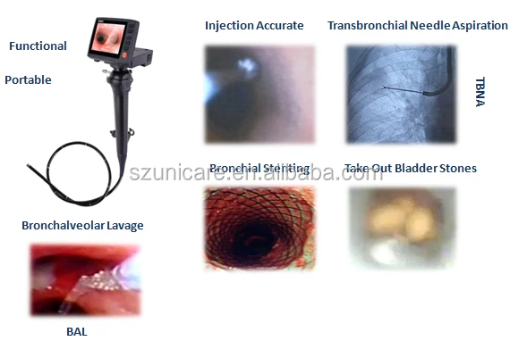 electronic video endoscope flexible fiber optic laryngoscope set