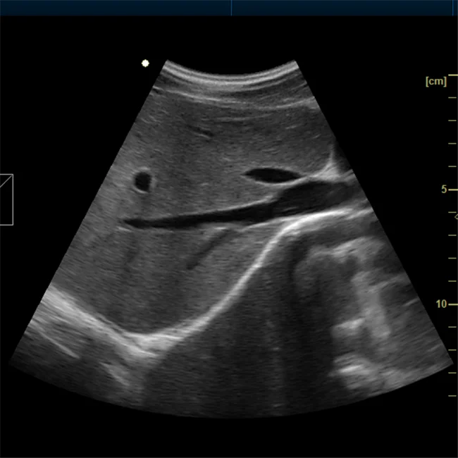 
15' LED Color ultrasound scanner Portable Digital Ultrasonic Color Diagnostic Imaging System 