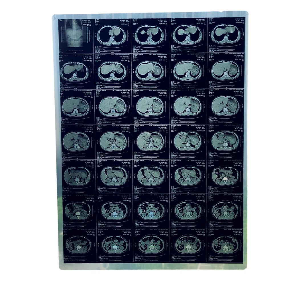 A3 inkjet blue/white x ray film for medical CT/DR/CR/MRI