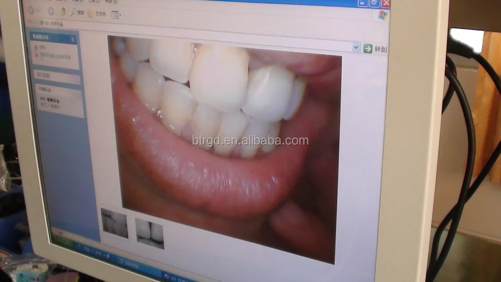 
BTR manufacturer of Oral Lamp with camera Dental Wireless Digital Intraoral Camera for Oral Examination 