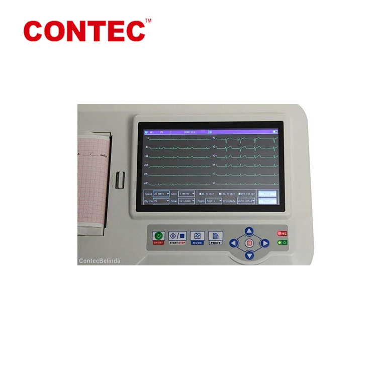 
CONTEC для домашнего использования, тестирование частоты сердечных сокращений, CE, цифровой, 3/6 каналов, ЭКГ, 600 г  (60806064269)