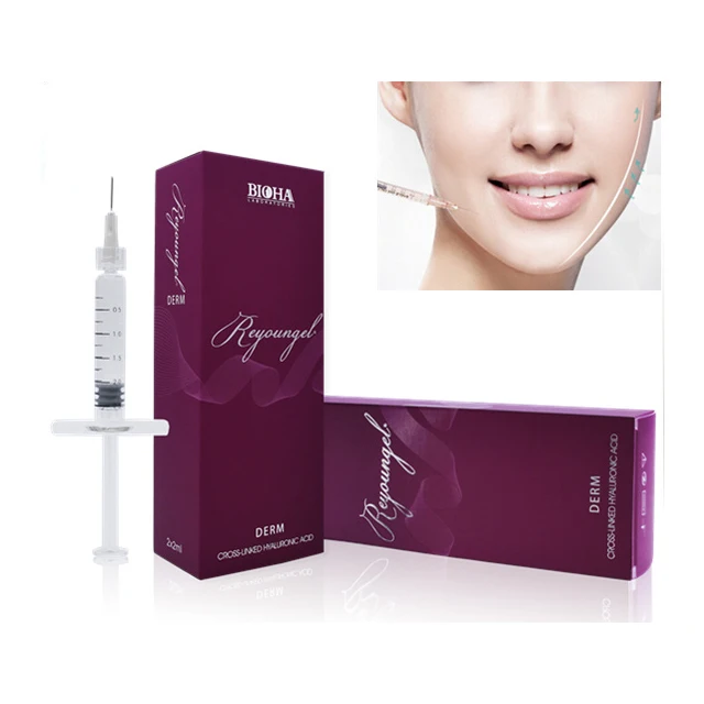 
Hyaluronate Acid Injection Dermal Filler for Remove Nasolabial Folds 