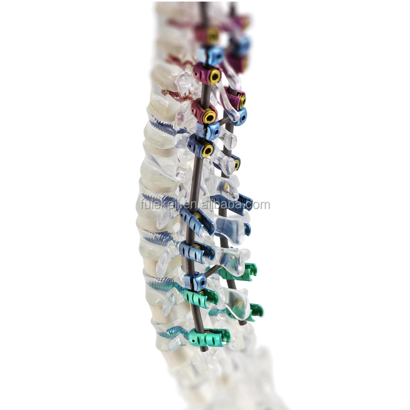
Cervical fusion cage 