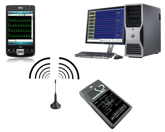 CardioScan Holter Satellite ECG Holter Satellite ECG