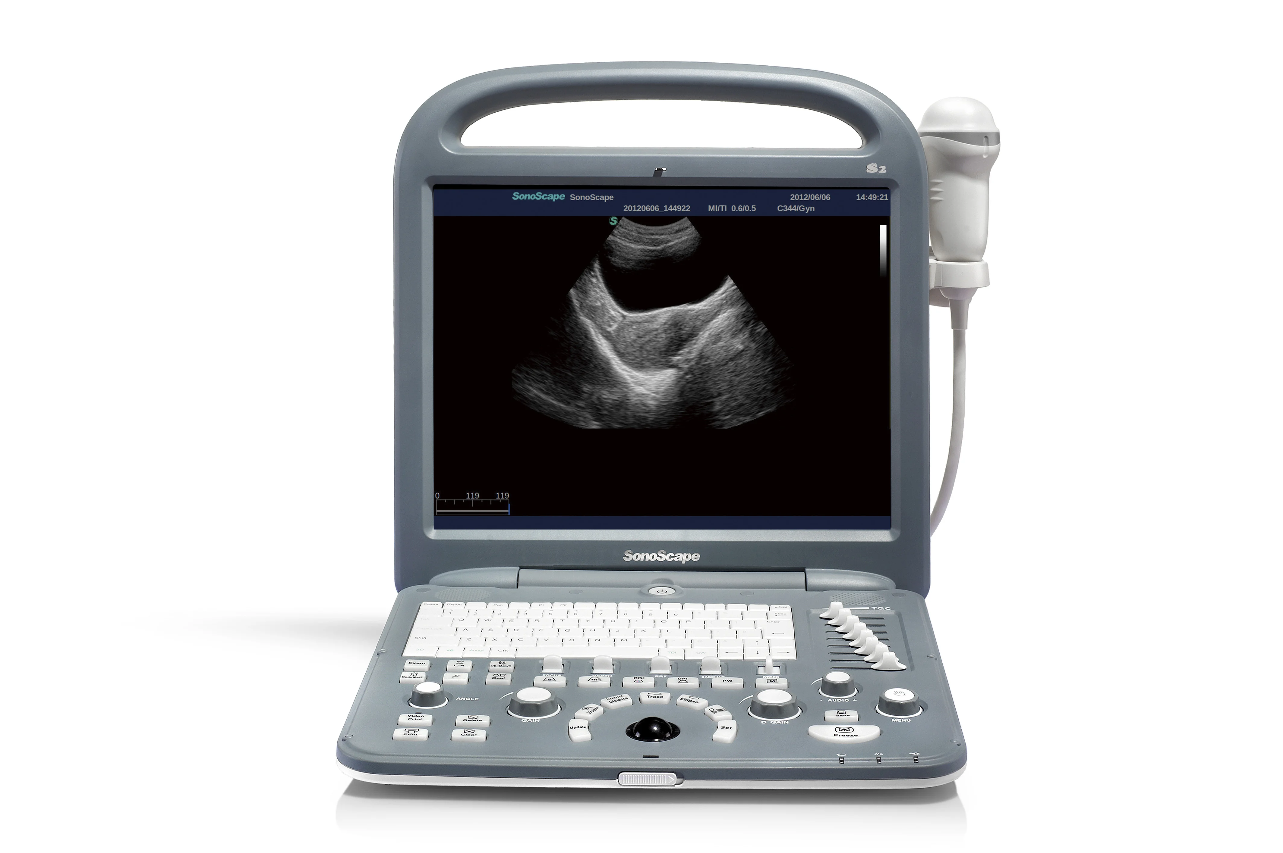 Famous color doppler ultrasound machine sonoscape p20 price