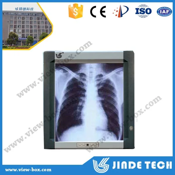 
high quality slim LED x-ray viewing box,x-ray viewing light box,negatoscope film viewer and led x ray film viewer 