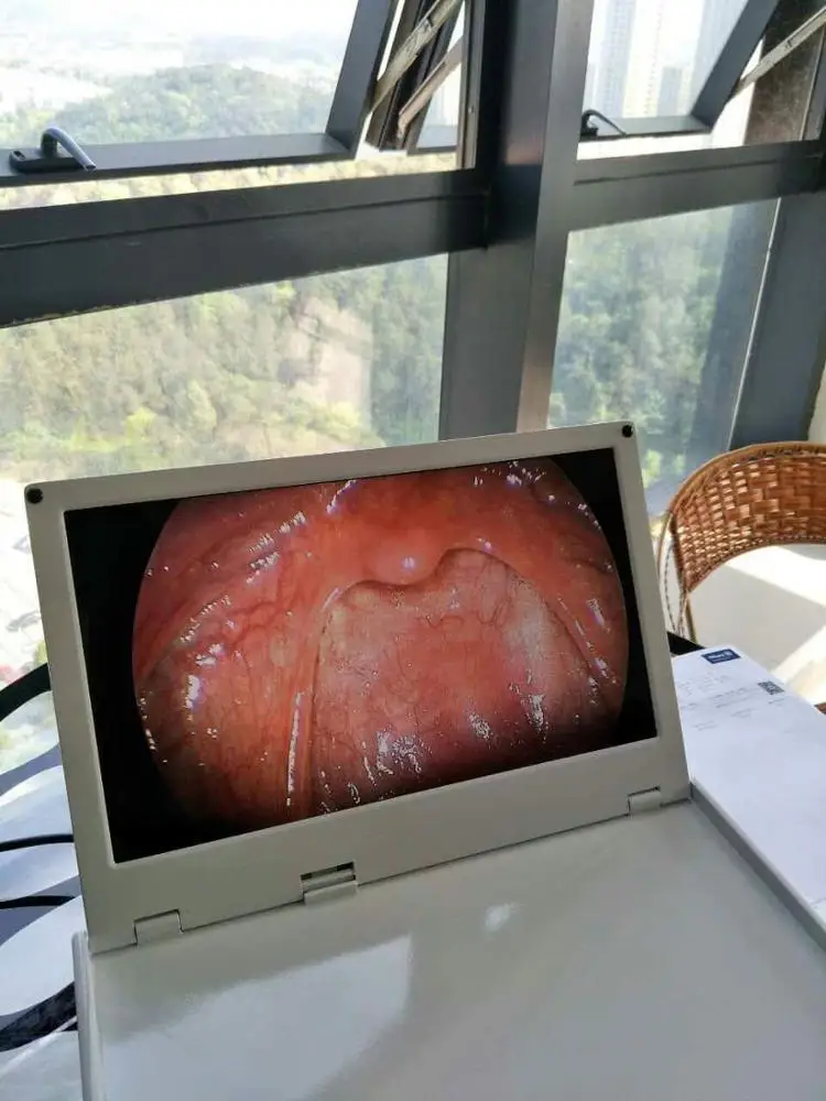 Surgical instruments endoscope camera/HD medical camera 16 inch