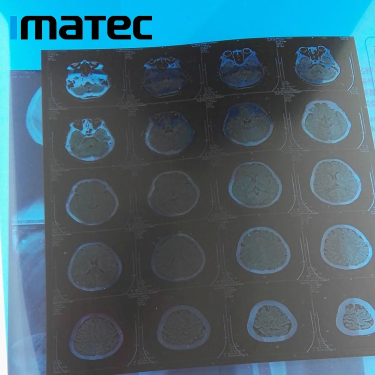 China Distribute 210um Laser Blue PET Based CR CT Medical X-ray Film For Xerox Printers