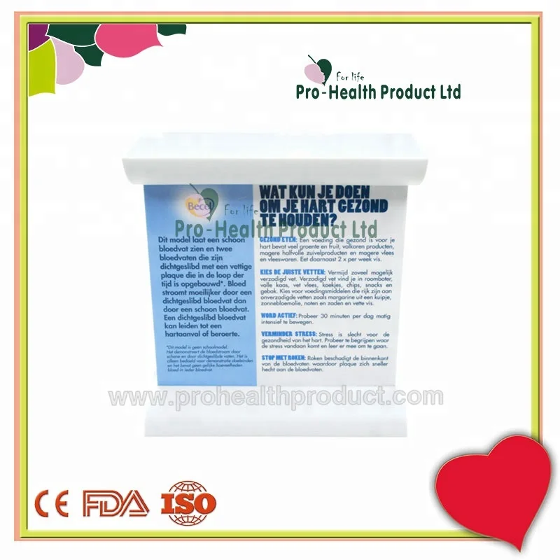 Dynamic vascular Blood Vessel Educational Teaching Model, LDL Low-density Lipoprotein Vascular Disease Model