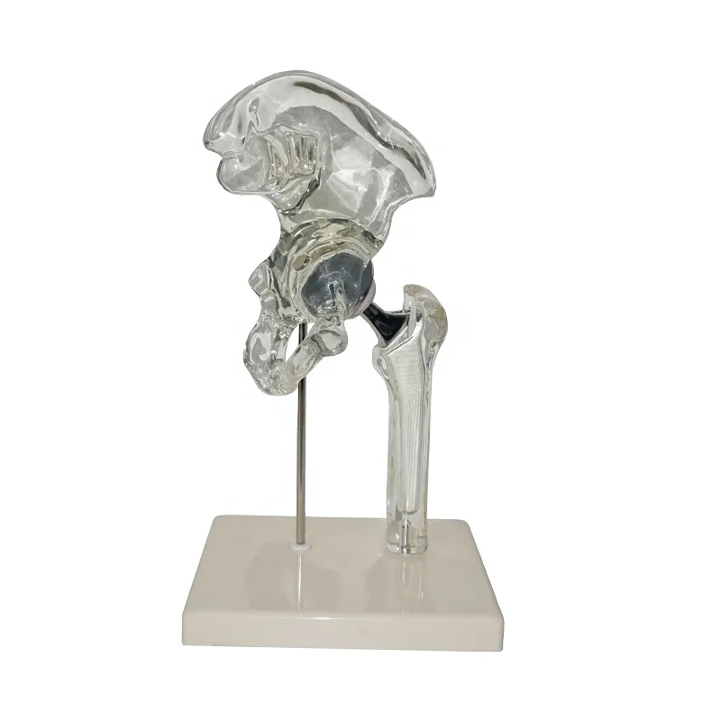 Medical Hip Implant Model