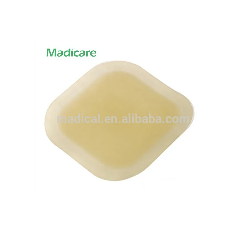 Поо липкая гидроколлоидная повязка на рану с рамкой для ухода за язвами при давлении наклейка пасту язвах