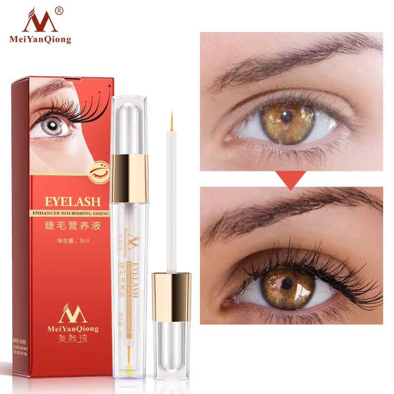 Травяное лечение для роста ресниц MeiYanQiong, жидкая сыворотка, лечение натуральных ресниц, удлинение ресниц