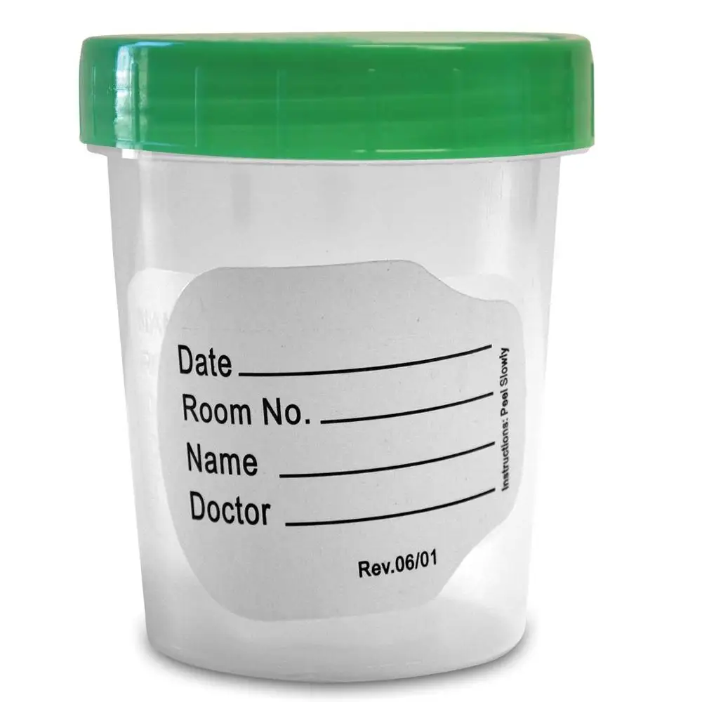 Lab disposable Specimen container Urine Sample Cup stool sample cup
