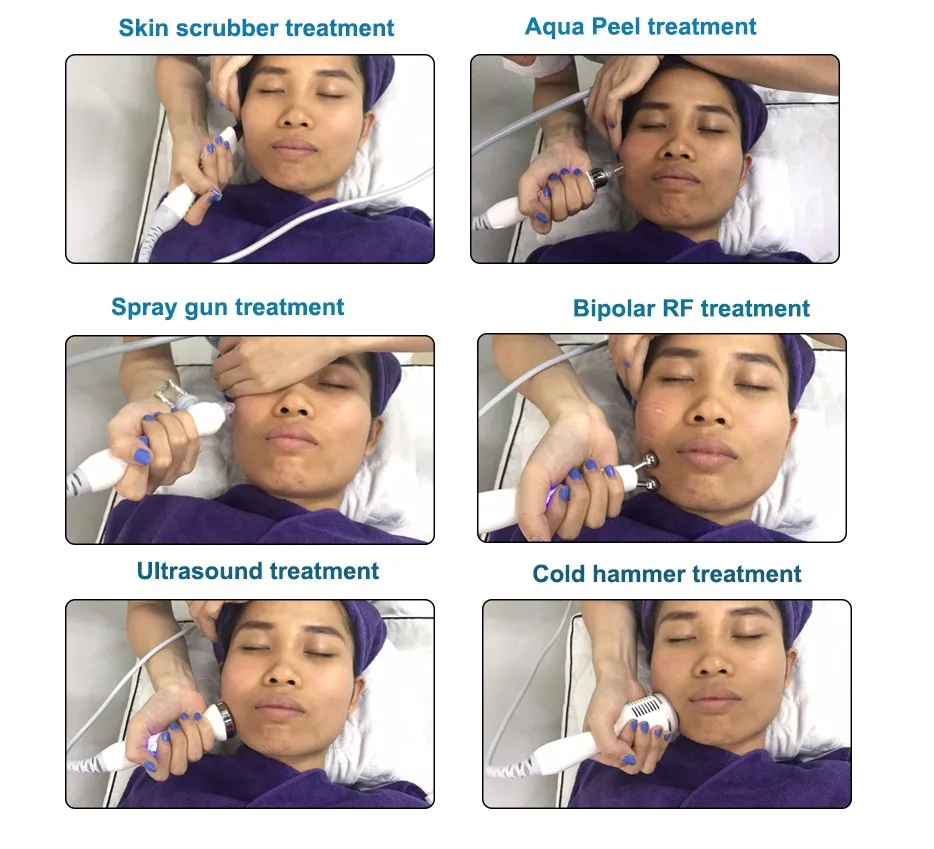 RF radio frequency hyperbaric oxygen facial machine for deep cleaning