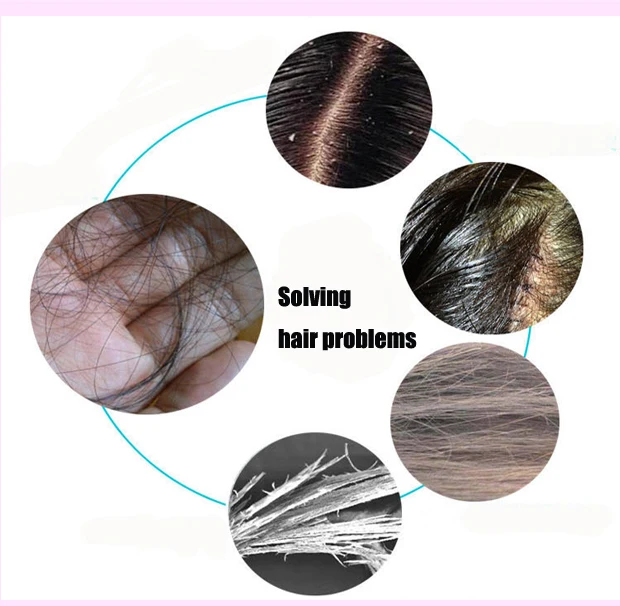 Amazon top seller electric laser hair comb massager scalp massager for hair growth