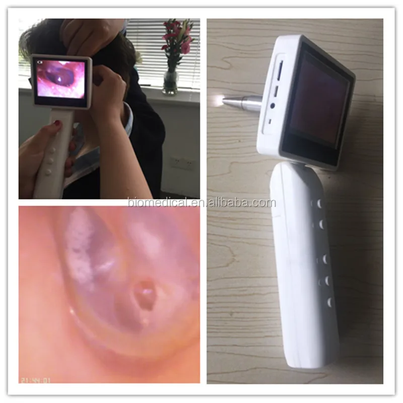 
Video Endoscopy ENT Surgical Instruments ENT Treatment Unit For Ear Throat Nasal 