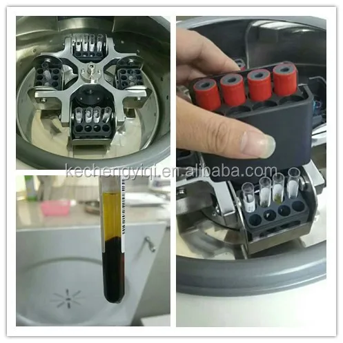 Manufacturer L3-5K Table top low speed 32 x 15ml Multi-Shelf Urine Sediment serological lab PRP basket centrifuge