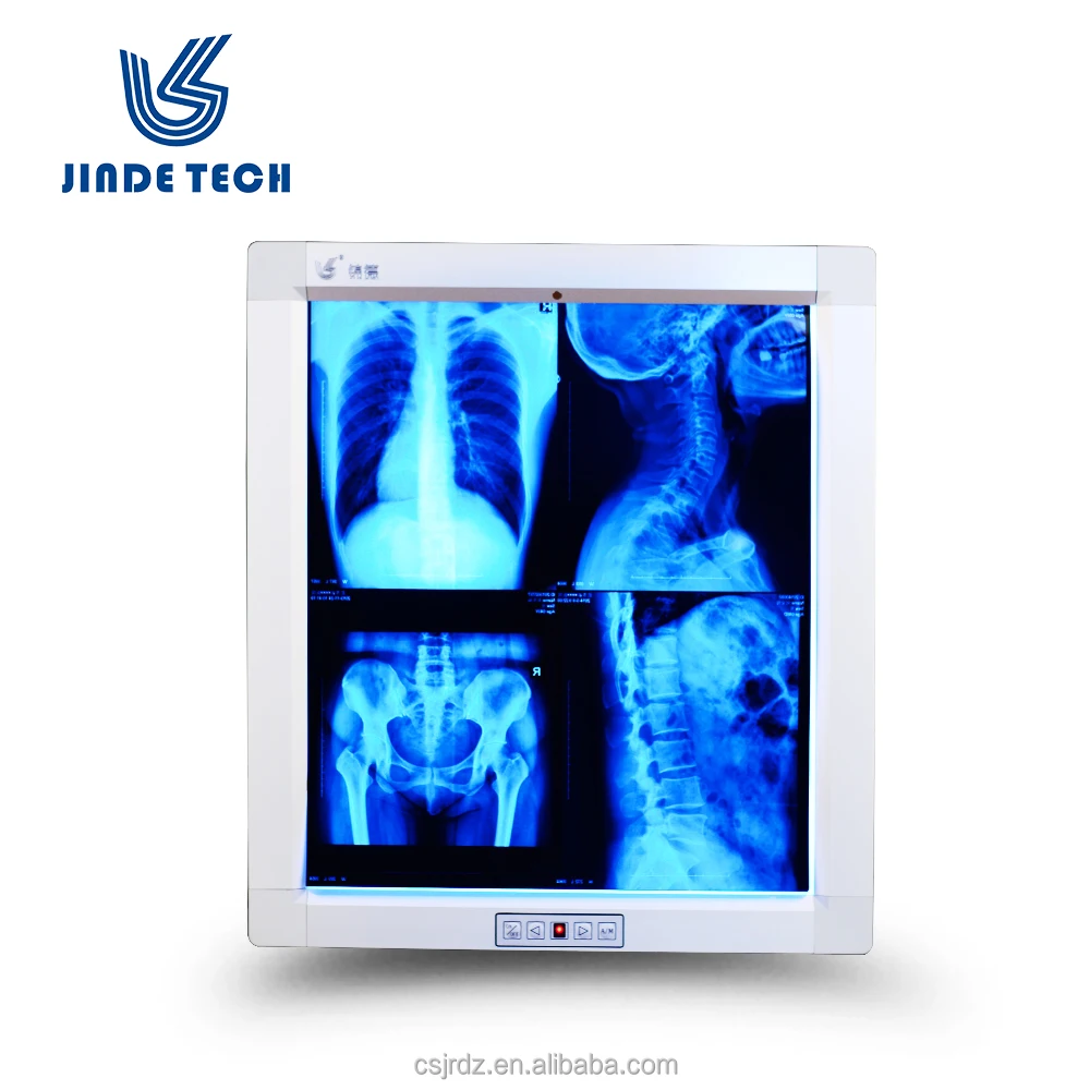 
Negatoscopio Single panel JD-01AIII high brightness X ray LED negatoscope 