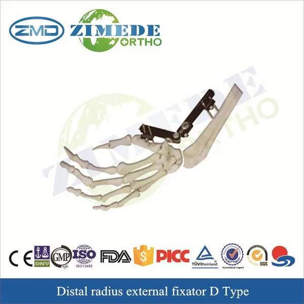2016 ZIMEDE Дистальный радиус фрагмент внешних фиксаторов использовать ортопедические производителей