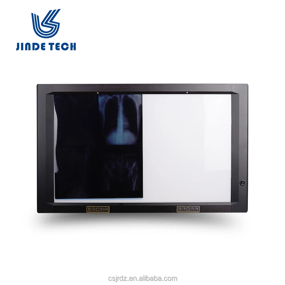 
Film viewer(medical)/x ray films negatoscope hot sell 