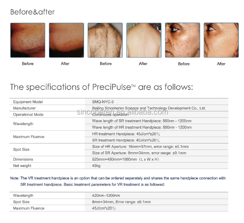 Для только что открытого косметического бизнеса, или вы планируете, 3 в 1, удаление волос, омоложение кожи и многофункциональное удаление пигментов