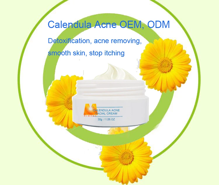 
Customizing anti acne function with your design calendula acne cream treatment 