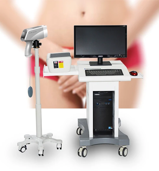 2020 Hot sale colposcope digital camera sony video colposcopy gynecologie for gynecology examination in hospital