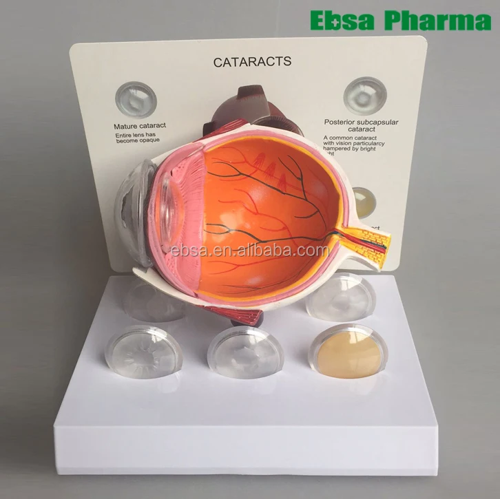 
Advanced Medical Supplies Human Plastic Cataracts Eye Model 