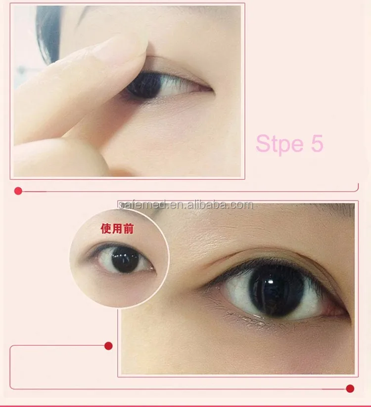 Nice double sided eyelid tape/Wonderful single sided eyelid tape/Double eyelid tape