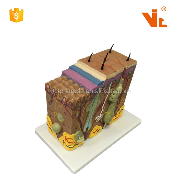 V-AM030 enlarged human psoriasis anatomical model design for teaching use