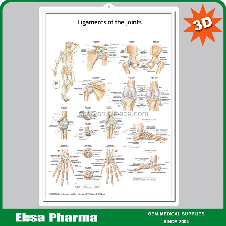 Educational Plastic 3D Medical Anatomical Wall Chart - Understanding Arthritis