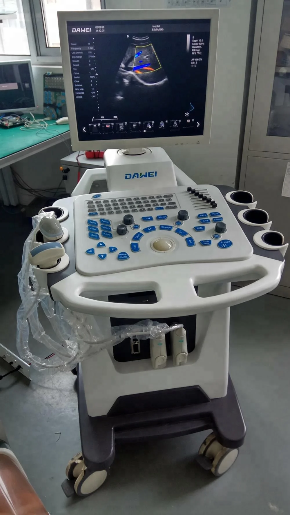 new tech color USG & real time color doppler & doppler ultrasound machine for pregnancy