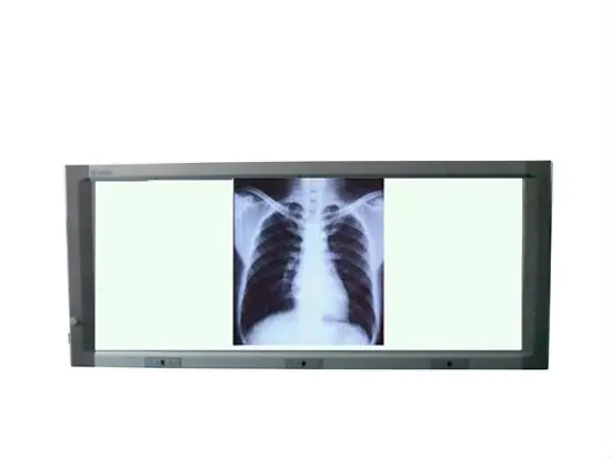 
radiographic x ray film viewer 
