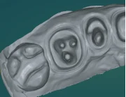 Портативный стоматологический сканер Demetdent SC360T, синий свет, 3D сканер