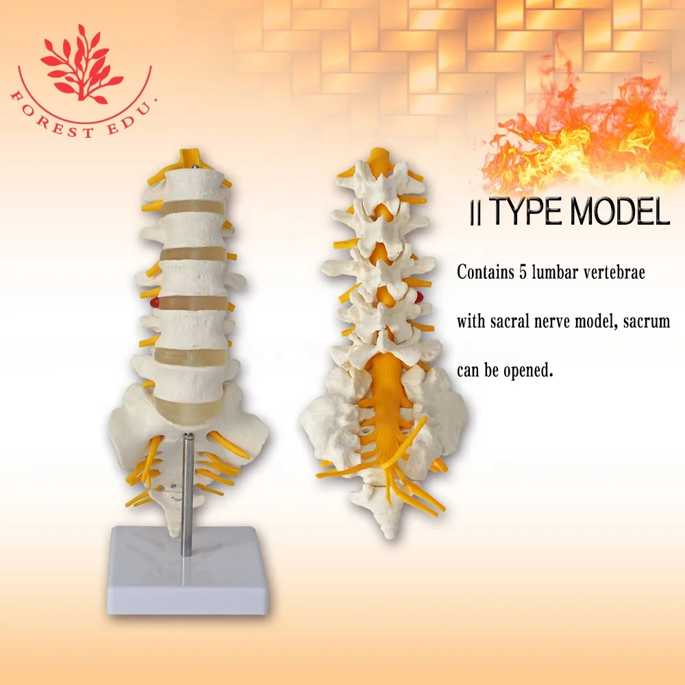 Поясничная модель 5 штук позвонков косточки нервных корешков и с правой стороны крестцового нерва седалищного филиал обучающие игрушки