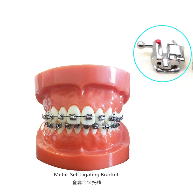 Ортодонтический производитель MIM пассивные самолигирующиеся Roth 022 обрабатываемые стоматологические кронштейны