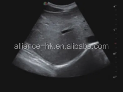 Sonoscape S22 Trolley 4D цветная допплеровская ультразвуковая система, 8 дюймов, сенсорный экран 18,5 дюйма, ЖК-дисплей