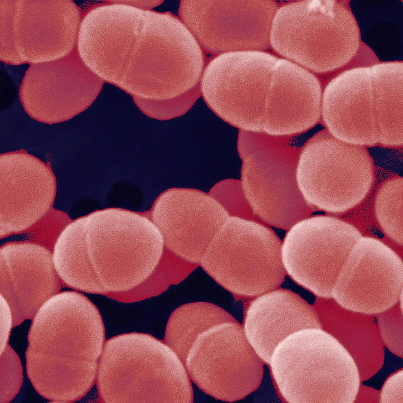 
High Quality Probiotic Lactococcus Lactis 