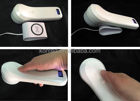 Ipad 4D Wireless Bladder Ultrasound Scanner for Urology