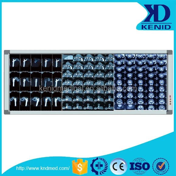 
KENID Top Brand X-ray Medical Film Viewer Xray Film Reader X Ray LED Viewing Box 