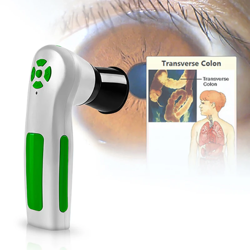 12 М пикселей глаз iriscope iridology камера цифровой здоровья анализатор