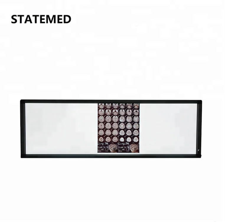 , Customized X-ray Film Viewer Box Medical View Box Led Negatoscope Medical X-ray Equipments & Accessories Class I 12kg 1424*425