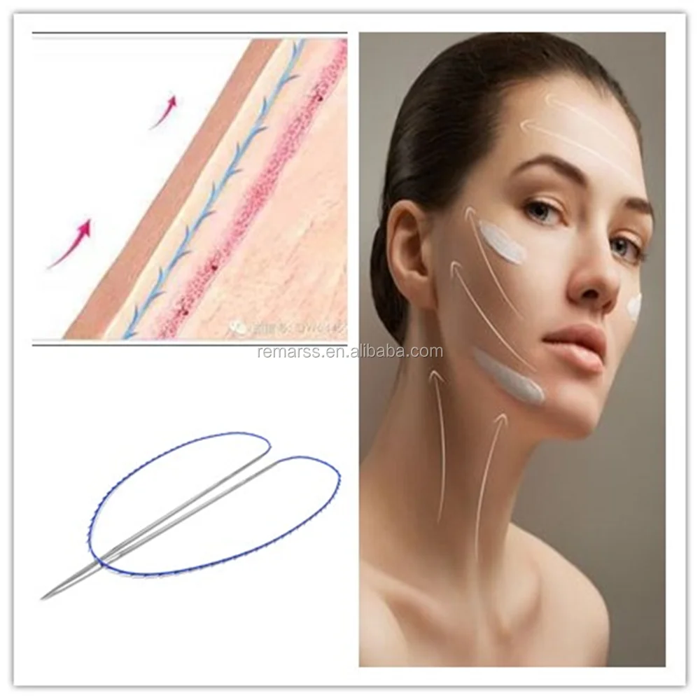 
korea polydioxanone suture fio lifting pdo double needle cog thread 