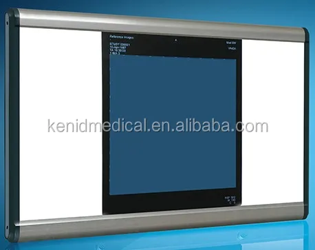 
Xray LED Viewing Box LED Medical X Ray Film Negatoscope LED X Ray Film Viewer 