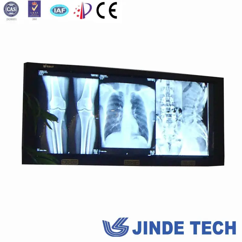 
radiographic x ray film viewer 